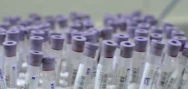 Official MGIMS hospital/facility image