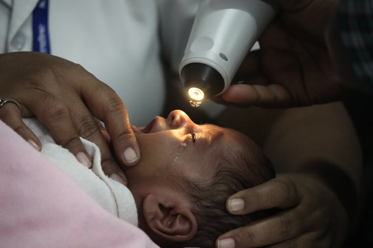 Baby screening ROP — L V Prasad Eye Institute