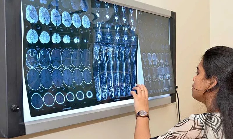 Radiology resident reading MRI films on a viewing panel at the SSIMS & RC teaching hospital, Davangere