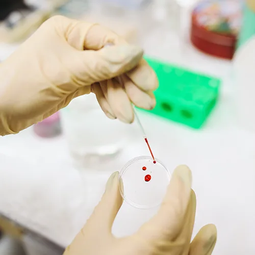 B.Sc in Cancer Biology - Allied Healthcare Science (UG) — School of Allied Healthcare & Sciences, JAIN (Deemed-to-be University)